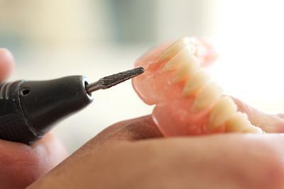 Person creating dentures | Dentist Pascoe Vale VIC