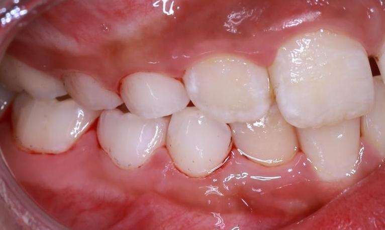 deep cleaning after | pascoe vale vic
